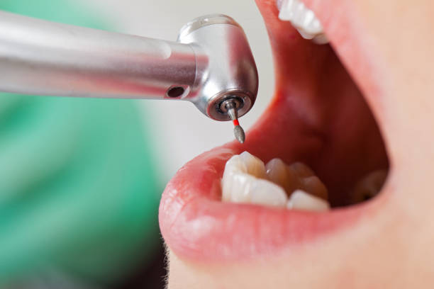 Best Dentist for Tooth Abscess  in Clayton, OH